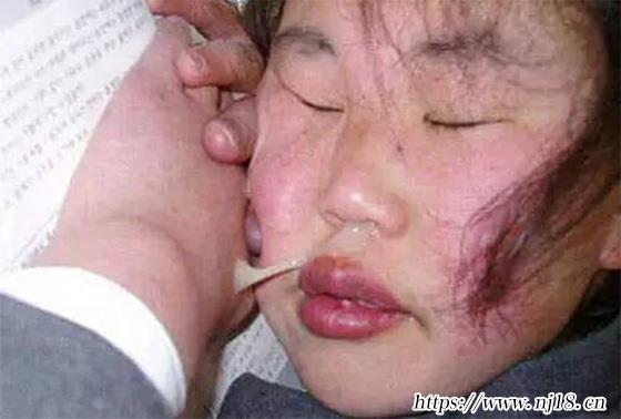 世界上最醜的十個女人排行，醜女圖片越醜越好